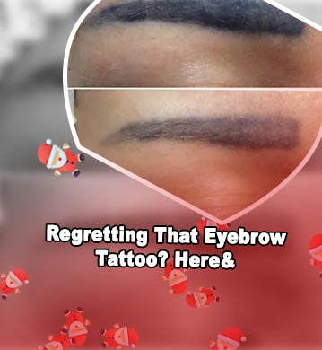 Remove permanent eyebrow tattoo